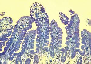 arteficially injured top of microvilli by the endoscope … semithin section arteficially injured top of microvilli by the endoscope … semithin section
